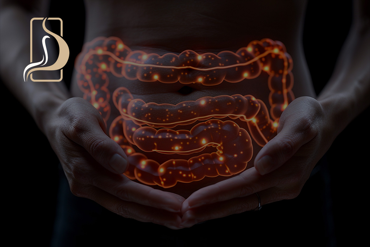 O que é GIST – Tumor Estromal Gastrointestinal